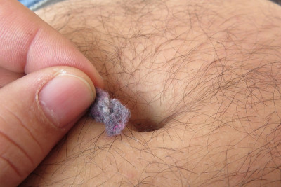what-is-belly-button-lint-2.jpg