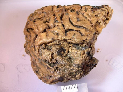 heslington-brain.jpg
